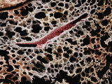 Mammal Lung  Showing Numerous Alveoli and Several Bronchioles