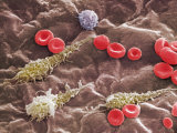 Red and White Blood Cells in a Portal Vein