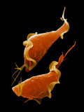 The Parasitic Protozoa Trichomonas Vaginalis Is the Cause of Vaginitis