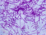 Anthrax Bacteria (Bacillus Anthracis)