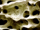 Human Femur Spongy or Cancellous Bone