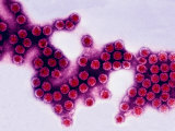 Simian Virus 40 (Sv40) Tem