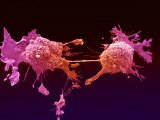 Lung Cancer  Electron Microscopy Unit  Cancer Research  UK