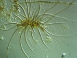 Calothrix Cyanobacteria