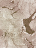 Section Through the Dermis of Human Skin Near a Mole Showing Fibroblasts Tem