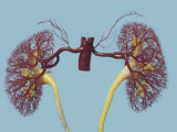 Resin Cast of Kidney and Suprarenal Arteries  Anterior Aspect