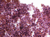 Section of Fetal Bone Marrow