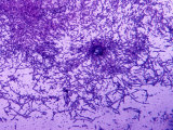 Anthrax Bacteria (Bacillus Anthracis)