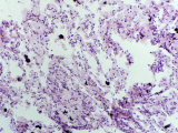 Collapsed Human Lung Tissue