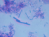 Human Oral Bacteria Phase Contrast