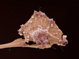 Breast Cancer  Electron Microscopy Unit  Cancer Research  UK