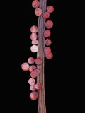Spherical Mitochondria on the Flagellum of a Mammal Sperm