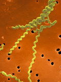 Leptospira Interrogans Is a Spiral-Shaped Bacteria Seen on a Membrane Filter