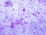 Separated Fibrin Network from a Human Blood Clot