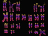 Karyotype of a Normal Human Female