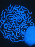 Human Chromosomes and the Cell Nucleus
