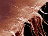 Human Eye  Showing the Attachment of the Zonule Fibers to the Lens