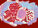 Herpes Viruses in a Cell
