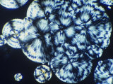 Cholesterol Crystals Viewed in Polarized Light