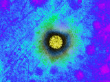 Papilloma Virus