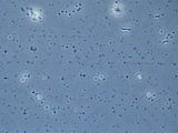 Vibrio Cholerae Bacteria  the Pathogen That Causes Cholera