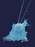 Breast Cancer  Electron Microscopy Unit  Cancer Research  UK