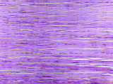 Longitudinal-Section of a Human Tendon Showing the Parallel Bundles of Collagen Fibers