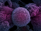 Prostate Cancer  Electron Microscopy Unit  Cancer Research  UK