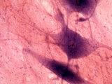 Multipolar Neurons