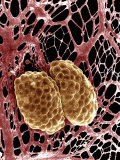 Fat Cells in Human Mesentery
