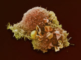 Lung Cancer  Electron Microscopy Unit  Cancer Research  UK
