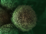 Human Pancreatic Cancer Cell  Cancer Research UK