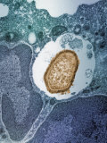 A Staphylococcus Bacterium Engulfed by a Macrophage or Phagocyte
