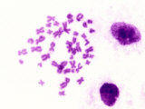 Human Male Chromosome Spread Next to Cells Brightfield
