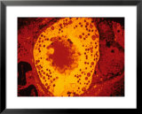 Primary causes of dementia include Tramadol Vs Tramadol Hcl number of neurological disorders.