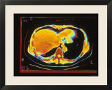 Normal+ct+scan+abdomen