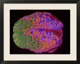 Human Brain Colorized