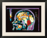 Digitized MRI Brain  Lateral View
