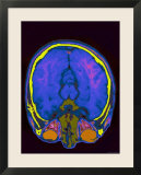 Brain Hemispheres Visible Colorized MRI Normal