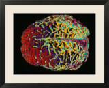 Human Brain Colorized