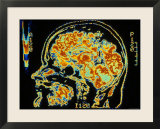 Digitized MRI Sagittal  Human Head