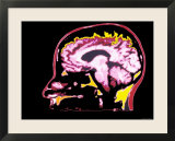 MRI Head Sagittal View Normal