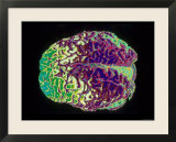 Human Brain Colorized