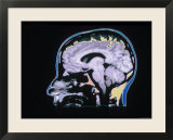 Color MRI Scan Head Skull Brain Normal X-Ray