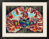 Brain Section  Cerebellum Section