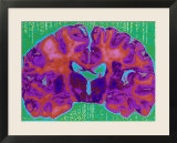 Dr Reading Catscans
