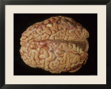 Human Brain  Specimen Cerebral Hemispheres View