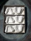 High Angle View of Dental Moulds in a Box