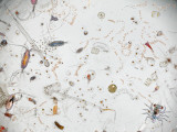 Under a Magnifier  a Splash of Seawater Teems with Life