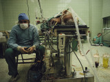 A Doctor Watches a Monitor Tracking the Vital Signs of a Patient